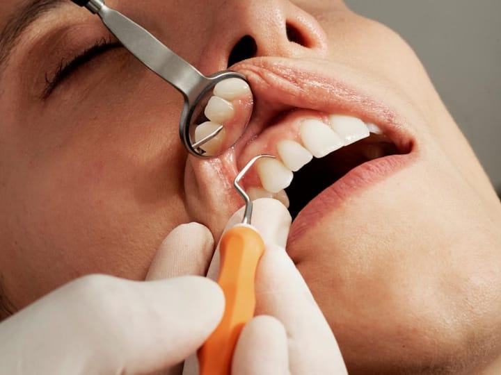 Yozgat Ağız ve Diş Sağlığı Merkezi'nde Yeni Dönem Implant Uygulamaları Başlıyor